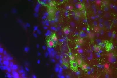 Verifying brain loci involved aggressive behavior using c-FOS expression as an indicator: activation of neurons containing candidate genes during aggression